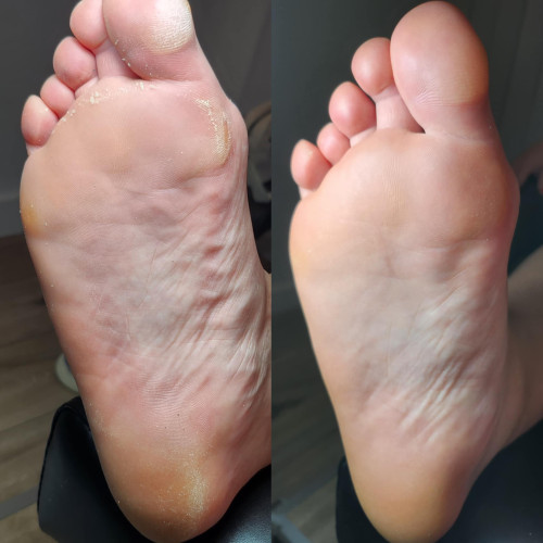 Footlogix Spa Footlogix Spa